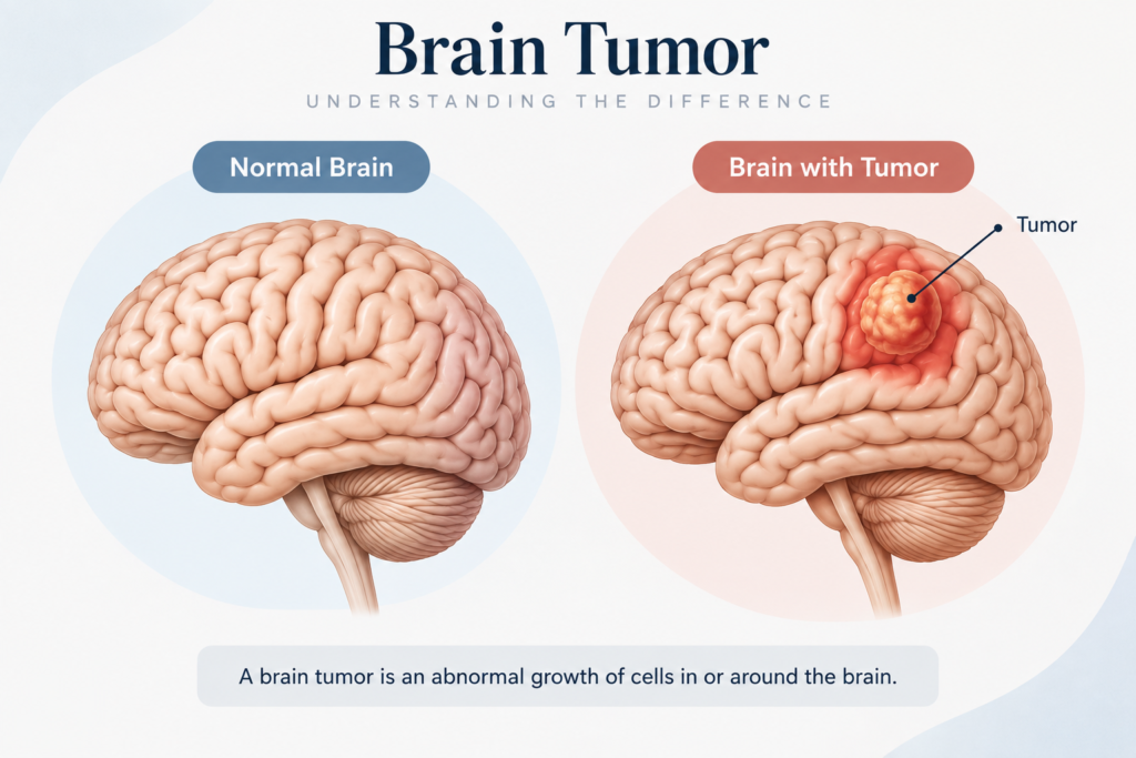 Normal Brain compared with a Brain tumor. illustrating brain tumor symptoms